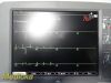 GE HEALTHCARE GE Mac 5500 ECG Machine W/ Mac Trolley, CAM-14 Module, Cable, & Battery