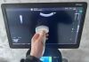 GE Logiq S8 XDclear R4.5 2019 MSK - Musculoskeletal