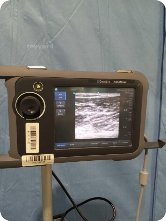 SONOSITE NanoMaxx  Portable Ultrasound System