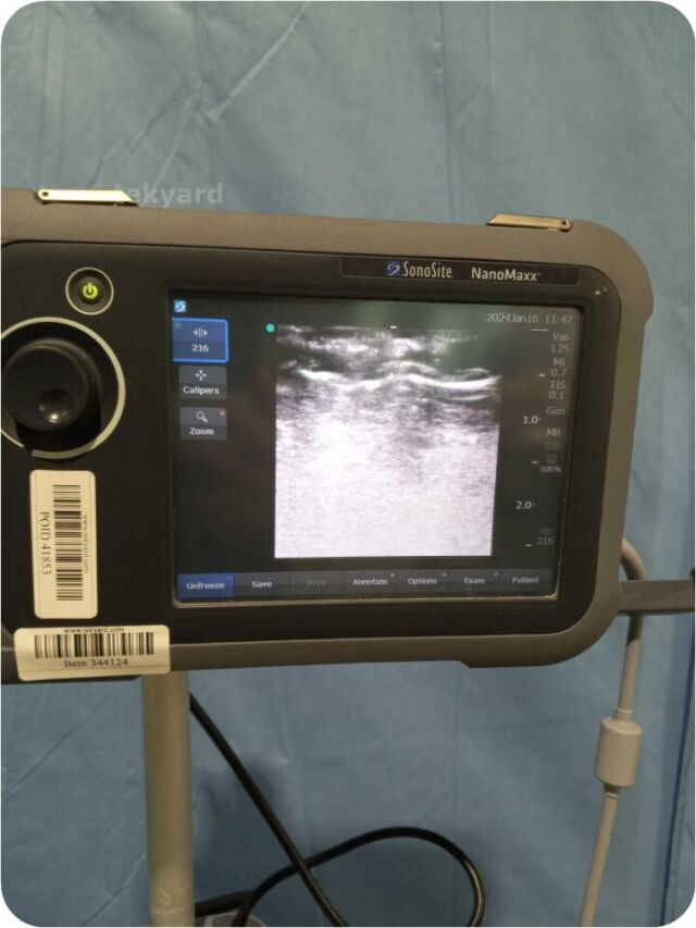 SONOSITE NanoMaxx  Portable Ultrasound System