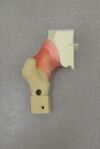 CHAMBERLAIN GROUP Hip Labrum Trainer 6005 W/ Case - 176727 Labrum Trainer