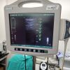 BARD Site Rite 6 Vascular Utlrasound