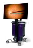 ALCON NGENUITY 3D Visualization System Alcon NGENUITY 3D Visualization System