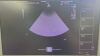 SIEMENS/ACUSON 4V1c Ultrasound Transducer