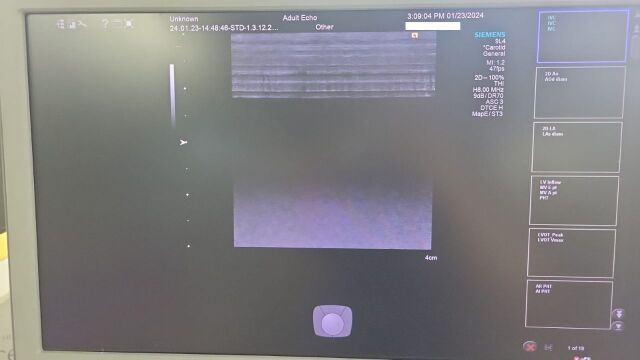 SIEMENS/ACUSON 9L4 Ultrasound Transducer