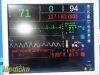 EloTouch Sys E108742 Nihon Kohden Touchscreen FlatPanel Monitor