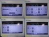 WELCH ALLYN 64MTXE VSM 6000 Series Patient Monitor
