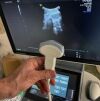 GE Voluson S10 Ultrasound - OB / GYN