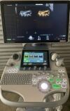 GE Voluson S10 Ultrasound - OB / GYN