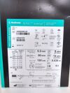 MEDTRONIC ADM06008013P In.Pact Admiral Paclitaxel Coated PTA Balloon Catheter 6.0mm x 80mm x , 130cm , 0.035” (Expired)