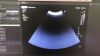 PHILIPS C9-2 Ultrasound Transducer