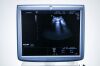 GE Voluson E6  Ultrasound