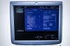 GE Voluson E6  Ultrasound