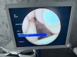 OLYMPUS VISERA ELITE OTV S190 Complete system Endoscope