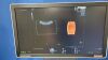 GE Voluson S8 Touch Ultrasound - OB / GYN