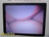 VERATHON 0570-0304 Glidescope Cobalt AVL Video Monitor