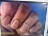 STRYKER Endoscopy 1588 Camera Head Coupler *TESTED*