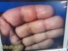 STRYKER Endoscopy 1588 Camera Head Coupler *TESTED*