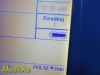 WELCH ALLYN Spot Vital Signs LXI ;Nellcor SpO2 W/ 2X Leads & Stand ~ Monitor