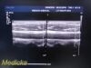 PHILIPS L17-5 Linear Array Ultrasound Transducer