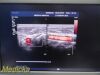 PHILIPS L17-5 Linear Array Ultrasound Transducer