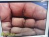 STRYKER Endoscopy AIM Ref 1588-020-122