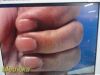 STRYKER Endoscopy AIM Ref 1588-020-122