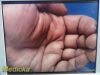 STRYKER Endoscopy AIM Ref 1588-020-122