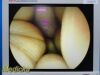 ARTHREX AR-3351-5500 HD,0° 5.5mm x 300mm W/ Case *TESTED* ~ Laparoscope
