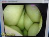 ARTHREX AR-3351-5530 HD , 5.5mm x 300mm, 30° Autoclavable, Case~ Laparoscope