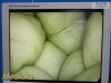 SMITH & NEPHEW 7207944 Rigid Telescope Laparoscope