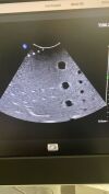 PHILIPS CX MC7-2 Micro Convex Compact Ultrasound Transducer