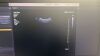 PHILIPS CX MC7-2 Micro Convex Compact Ultrasound Transducer