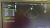 GE L4-12T-Rs Ultrasound Transducer