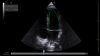 GE Venue R4 Touch Ultrasound System