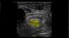 GE Venue R4 Touch Ultrasound System