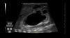 GE Venue R4 Touch Ultrasound System