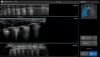 GE Venue R4 Touch Ultrasound System