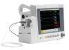 EDAN iM50 Monitor