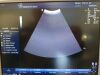 GE 4C Ultrasound Transducer