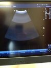 GE 4C Ultrasound Transducer