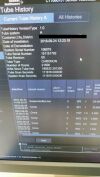 SIEMENS Go! Now CT Scanner