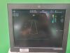 GE Vivid E9 xDClear Ultrasound Scanner (Version: 11.3) (Year: 2015)