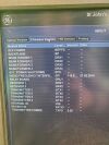 GE Vivid E9 xDClear Ultrasound Scanner (Version: 11.3) (Year: 2015)