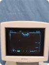 SHIMADZU Sarano 541-50047 Diagnostic Ultrasound System