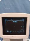 SHIMADZU Sarano 541-50047 Diagnostic Ultrasound System