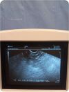 SHIMADZU Sarano 541-50047 Diagnostic Ultrasound System