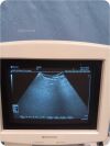 SHIMADZU Sarano 541-50047 Diagnostic Ultrasound System