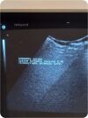 SHIMADZU Sarano 541-50047 Diagnostic Ultrasound System