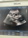 PHILIPS CX50 Ultrasound - Cardiac - Vascular